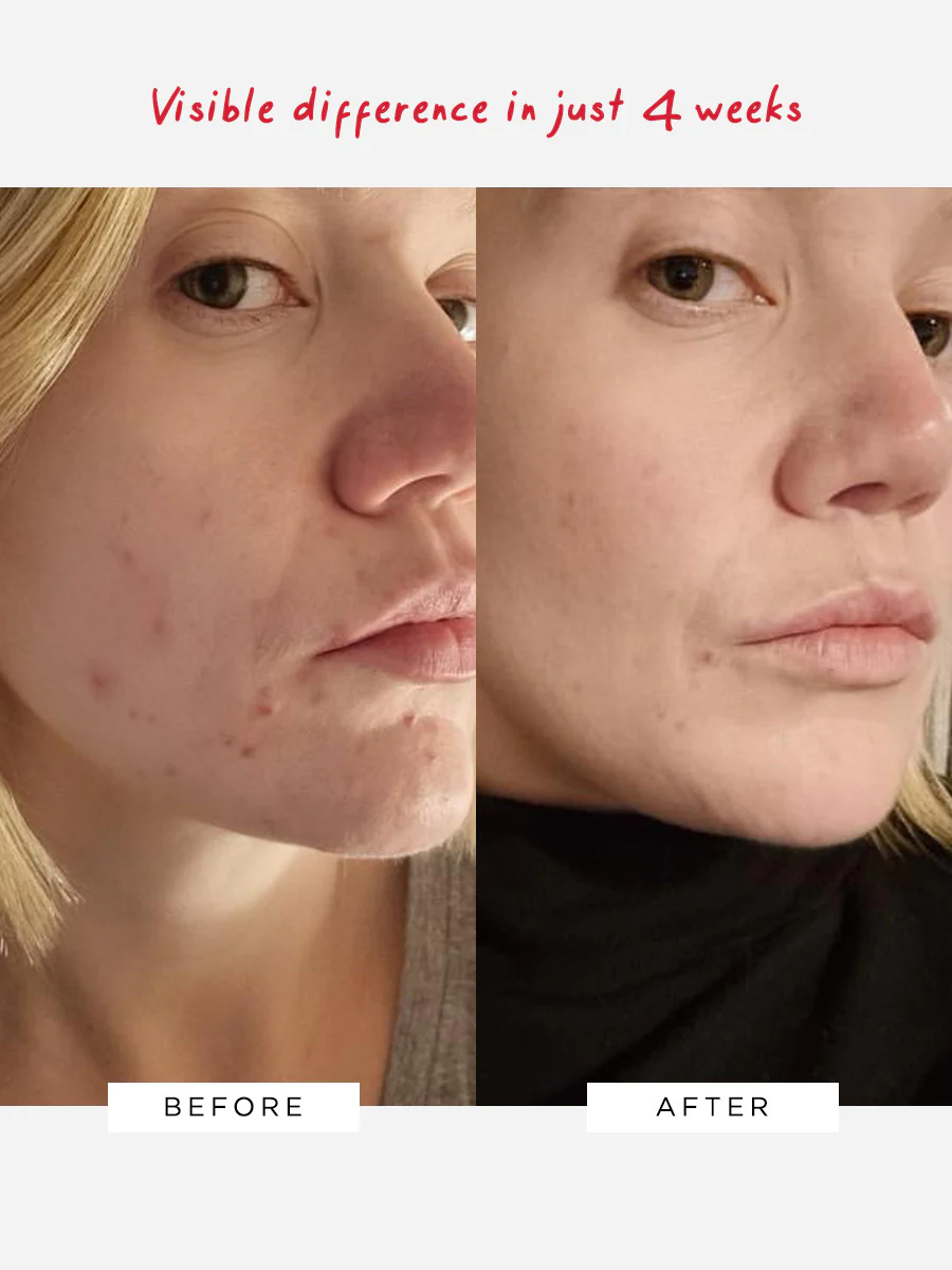 Flawless Neutralising Gel (HPRA - DO NOT USE) - Image 3