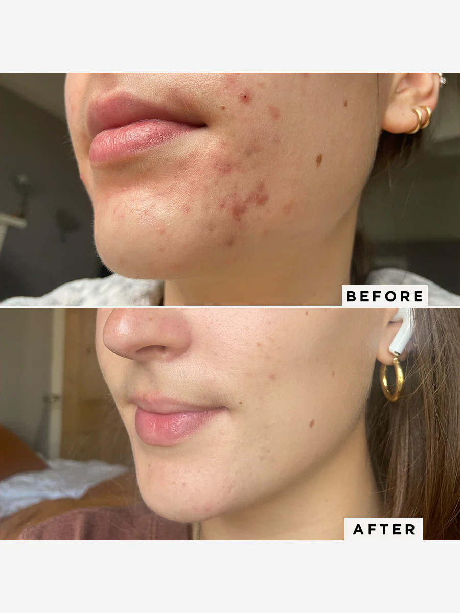 Flawless Neutralising Gel (HPRA - DO NOT USE) - Image 6