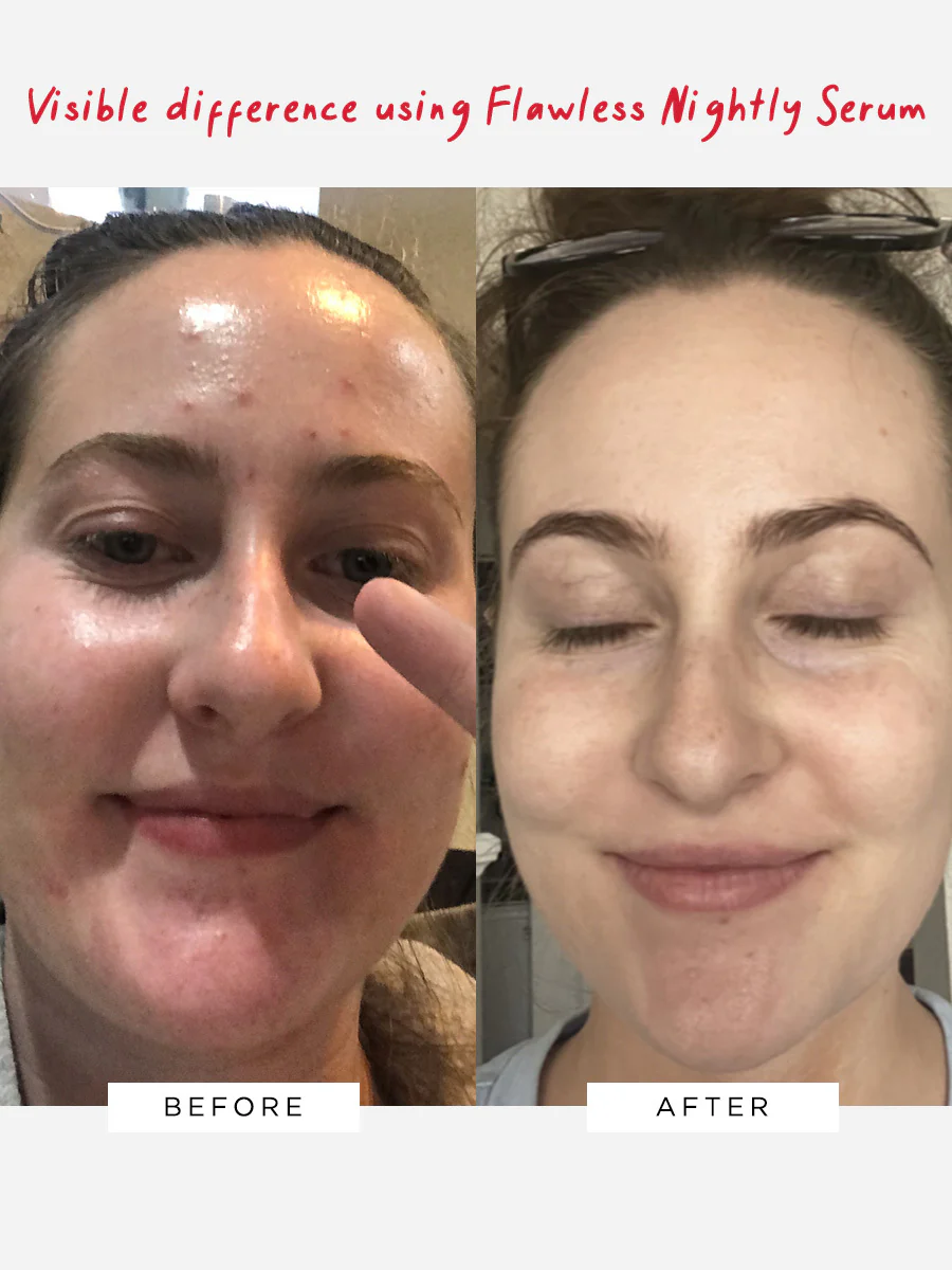 Flawless Nightly 2% Retinoid Serum (HPRA - DO NOT USE) - Image 3