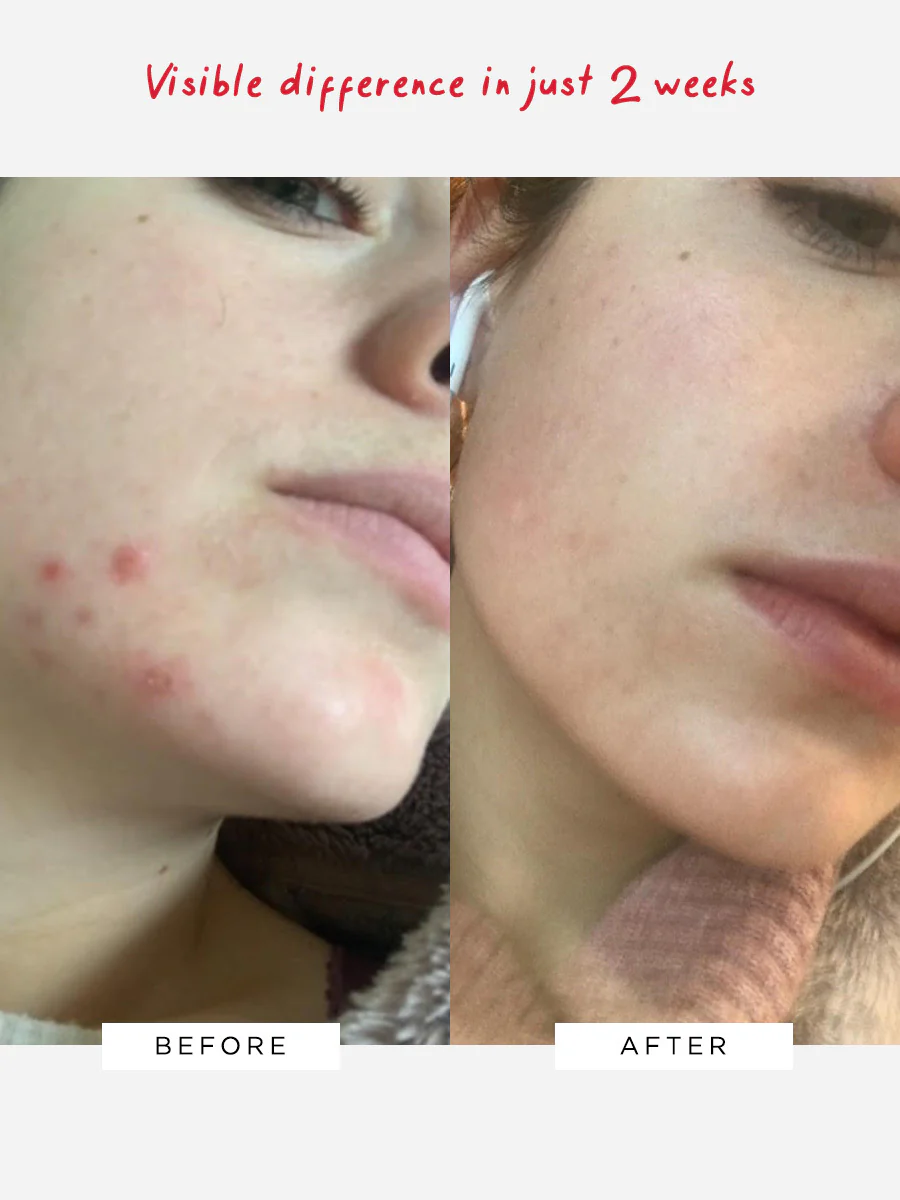 Flawless Nightly Pro 5% Retinoid Serum (HPRA - DO NOT USE) - Image 3